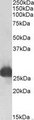GSTA3 Antibody - GSTA3 antibody (0.1 ug/ml) staining of Rat Liver lysate (35 ug protein/ml in RIPA buffer). Primary incubation was 1 hour. Detected by chemiluminescence.