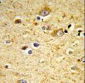 GSTA4 Antibody - Formalin-fixed and paraffin-embedded human brain tissue reacted with GSTA4 Antibody , which was peroxidase-conjugated to the secondary antibody, followed by DAB staining. This data demonstrates the use of this antibody for immunohistochemistry; clinical relevance has not been evaluated.