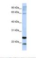 GSTA4 Antibody - Jurkat cell lysate. Antibody concentration: 1.0 ug/ml. Gel concentration: 12%.  This image was taken for the unconjugated form of this product. Other forms have not been tested.