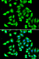 GSTCD Antibody - Immunofluorescence analysis of A549 cells.