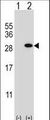 GSTT1 Antibody - Western blot of GSTT1 (arrow) using rabbit polyclonal GSTT1 Antibody. 293 cell lysates (2 ug/lane) either nontransfected (Lane 1) or transiently transfected (Lane 2) with the GSTT1 gene.