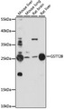 GSTT2B Antibody - Western blot analysis of extracts of various cell lines, using GSTT2B antibody at 1:1000 dilution. The secondary antibody used was an HRP Goat Anti-Rabbit IgG (H+L) at 1:10000 dilution. Lysates were loaded 25ug per lane and 3% nonfat dry milk in TBST was used for blocking. An ECL Kit was used for detection and the exposure time was 120s.