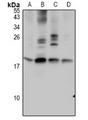 GTF2A2 / TFIIA Antibody - Western blot analysis of TF2A2 expression in H9C2 (A), AML12 (B), HEK293T (C), A549 (D) whole cell lysates.