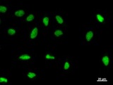 GTF2E2 Antibody - Immunostaining analysis in HeLa cells. HeLa cells were fixed with 4% paraformaldehyde and permeabilized with 0.1% Triton X-100 in PBS. The cells were immunostained with anti-GTF2E2 mAb.