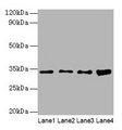 GTF2E2 Antibody - Western blot All lanes: Transcription initiation factor IIE subunit beta antibody at 2µg/ml Lane 1: Mouse brain tissue Lane 2: Hela whole cell lysate Lane 3: MCF-7 whole cell lysate Lane 4: PC-3 whole cell lysate Secondary Goat polyclonal to rabbit IgG at 1/10000 dilution Predicted band size: 33 kDa Observed band size: 33 kDa