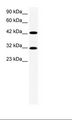 GTF2H2 Antibody - HepG2 Cell Lysate.  This image was taken for the unconjugated form of this product. Other forms have not been tested.