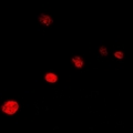 GTF2H3 Antibody - Immunofluorescent analysis of TFIIH p34 staining in A549 cells. Formalin-fixed cells were permeabilized with 0.1% Triton X-100 in TBS for 5-10 minutes and blocked with 3% BSA-PBS for 30 minutes at room temperature. Cells were probed with the primary antibody in 3% BSA-PBS and incubated overnight at 4 deg C in a humidified chamber. Cells were washed with PBST and incubated with a DyLight 594-conjugated secondary antibody (red) in PBS at room temperature in the dark.