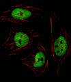 GTF2I / TFII I Antibody - Fluorescent image of HeLa cell stained with GTF2I Antibody. HeLa cells were fixed with 4% PFA (20 min), permeabilized with Triton X-100 (0.1%, 10 min), then incubated with GTF2I primary antibody (1:25, 1 h at 37°C). For secondary antibody, Alexa Fluor 488 conjugated donkey anti-rabbit antibody (green) was used (1:400, 50 min at 37°C). Cytoplasmic actin was counterstained with Alexa Fluor 555 (red) conjugated Phalloidin (7units/ml, 1 h at 37°C). GTF2I immunoreactivity is localized to Nucleus significantly.