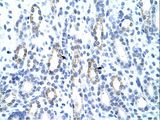 GTF3 / GTF2IRD1 Antibody - GTF2IRD1 antibody ARP39254_T100-NP_057412-GTF2IRD1(GTF2I repeat domain containing 1) Antibody was used in IHC to stain formalin-fixed, paraffin-embedded human kidney.  This image was taken for the unconjugated form of this product. Other forms have not been tested.