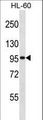 GTF3C2 Antibody - GTF3C2 Antibody western blot of HL-60 cell line lysates (35 ug/lane). The GTF3C2 antibody detected the GTF3C2 protein (arrow).