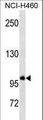 GTF3C3 Antibody - GTF3C3 Antibody western blot of NCI-H460 cell line lysates (35 ug/lane). The GTF3C3 antibody detected the GTF3C3 protein (arrow).