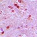 GTF3C3 Antibody - Immunohistochemical analysis of GTF3C3 staining in human brain formalin fixed paraffin embedded tissue section. The section was pre-treated using heat mediated antigen retrieval with sodium citrate buffer (pH 6.0). The section was then incubated with the antibody at room temperature and detected using an HRP conjugated compact polymer system. DAB was used as the chromogen. The section was then counterstained with hematoxylin and mounted with DPX.