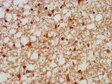 GTF3C5 Antibody - Immunohistochemistry image at a dilution of 1:100 and staining in paraffin-embedded human brain tissue performed on a Leica BondTM system. After dewaxing and hydration, antigen retrieval was mediated by high pressure in a citrate buffer (pH 6.0) . Section was blocked with 10% normal goat serum 30min at RT. Then primary antibody (1% BSA) was incubated at 4 °C overnight. The primary is detected by a biotinylated secondary antibody and visualized using an HRP conjugated SP system.