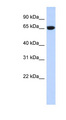 GTPBP2 Antibody - GTPBP2 antibody Western blot of Transfected 293T cell lysate. This image was taken for the unconjugated form of this product. Other forms have not been tested.