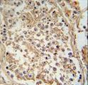 GTPBP2 Antibody - GTPBP2 antibody immunohistochemistry of formalin-fixed and paraffin-embedded human testis tissue followed by peroxidase-conjugated secondary antibody and DAB staining.