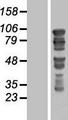 GTSE1 Protein - Western validation with an anti-DDK antibody * L: Control HEK293 lysate R: Over-expression lysate