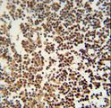GTSF1 Antibody - GTSF1 antibody immunohistochemistry of formalin-fixed and paraffin-embedded human lymph tissue followed by peroxidase-conjugated secondary antibody and DAB staining.