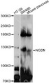 GUCY2C / Guanylyl Cyclase C Antibody - Western blot analysis of extracts of various cell lines, using GUCY2C antibody at 1:1000 dilution. The secondary antibody used was an HRP Goat Anti-Rabbit IgG (H+L) at 1:10000 dilution. Lysates were loaded 25ug per lane and 3% nonfat dry milk in TBST was used for blocking. An ECL Kit was used for detection and the exposure time was 30s.