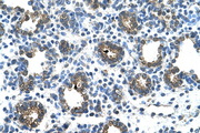 GUSB / Beta Glucuronidase Antibody - GUSB antibody ARP44234_T100-NP_000172-GUSB(glucuronidase, beta) Antibody IHC of formalin-fixed, paraffin-embedded human Lung. Positive label: Alveolar cells indicated with arrows. Antibody concentration 4-8 ug/ml. Magnification 400X.  This image was taken for the unconjugated form of this product. Other forms have not been tested.