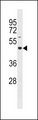 GXYLT2 Antibody - GLT8D4 Antibody western blot of SK-BR-3 cell line lysates (35 ug/lane). The GLT8D4 antibody detected the GLT8D4 protein (arrow).