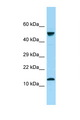 GYPA / CD235a / Glycophorin A Antibody - GYPA / Glycophorin A antibody Western blot of Fetal Kidney lysate. Antibody concentration 1 ug/ml.  This image was taken for the unconjugated form of this product. Other forms have not been tested.