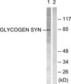 GYS1 / Glycogen Synthase Antibody - Western blot analysis of lysates from HeLa cells, treated with Serum 20% 30', using Glycogen Synthase Antibody. The lane on the right is blocked with the synthesized peptide.