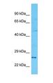 GZMH / Granzyme H Antibody - Western blot of GZMH Antibody with human 786-0 Whole Cell lysate.  This image was taken for the unconjugated form of this product. Other forms have not been tested.