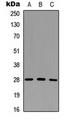 GZMM / Granzyme M Antibody - Western blot analysis of Granzyme M expression in HeLa (A); PC12 (B); NS-1 (C) whole cell lysates.