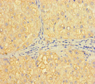 H2AFB1 Antibody - Immunohistochemistry of paraffin-embedded human liver tissue using H2AFB1 Antibody at dilution of 1:100