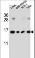 H2AFJ Antibody - H2AFJ Antibody western blot of Jurkat,MDA-MB435,MCF-7,HeLa cell line lysates (35 ug/lane). The H2AFJ antibody detected the H2AFJ protein (arrow).