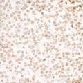 H2AFX / H2AX Antibody - Detection of mouse H2AX by immunohistochemistry. Sample: FFPE section of mouse CT26 colon carcinoma. Antibody: Affinity purified goat anti- H2AX used at a dilution of 1:1,000 (1µg/ml). Detection: DAB