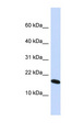 H2AFX / H2AX Antibody - H2AFX / H2AX antibody Western blot of HepG2 cell lysate. This image was taken for the unconjugated form of this product. Other forms have not been tested.