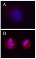 H2AFX / H2AX Antibody - Untreated Hela cells (Panel A), or overnight nocodazole treated Hela cells (Panel B) stained with purified mouse monoclonal antibody against Ser139 phosphorylated H2A.X, followed by Rhodamine Red-X conjugated Donkey anti-mouse IgG and DAPI.