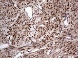 H2AFY2 Antibody - IHC of paraffin-embedded Human endometrium tissue using anti-H2AFY2 mouse monoclonal antibody. (Heat-induced epitope retrieval by 1 mM EDTA in 10mM Tris, pH8.5, 120°C for 3min).