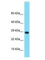 H2BFM Antibody - H2BFM antibody Western Blot of Fetal Brain. Antibody dilution: 1 ug/ml.  This image was taken for the unconjugated form of this product. Other forms have not been tested.