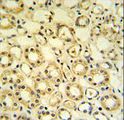 H6PD / G6PDH Antibody - H6PD Antibody IHC of formalin-fixed and paraffin-embedded lung tissue followed by peroxidase-conjugated secondary antibody and DAB staining.