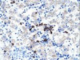 HABT1 / ABT1 Antibody - ABT1 antibody ARP32603_T100-NP_037507-ABT1 (activator of basal transcription 1) Antibody was used in IHC to stain formalin-fixed, paraffin-embedded human liver.  This image was taken for the unconjugated form of this product. Other forms have not been tested.