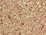 HABT1 / ABT1 Antibody - Immunohistochemistry image of paraffin-embedded human brain tissue at a dilution of 1:100