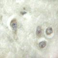 HAK / ALPK2 Antibody - 1/100 staining human brain tissue by IHC-P. The sample was formaldehyde fixed and a heat mediated antigen retrieval step in citrate buffer was performed. The sample was then blocked and incubated with the antibody for 1.5 hours at 22°C. An HRP conjugated goat anti-rabbit antibody was used as the secondary antibody.