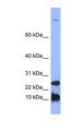 HAMP / Hepcidin Antibody - HAMP / Hepcidin antibody Western blot of Fetal Spleen lysate. This image was taken for the unconjugated form of this product. Other forms have not been tested.