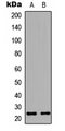 HAND1 Antibody - Western blot analysis of HAND1 expression in HeLa (A); H9C2 (B) whole cell lysates.