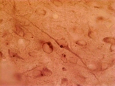 HAP1 Antibody - Staining of rat hypothalamus.  This image was taken for the unconjugated form of this product. Other forms have not been tested.