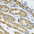 HAPLN1 Antibody - Immunohistochemistry of paraffin-embedded human stomach tissue.