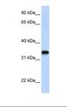 HAS3 Antibody - Transfected 293T cell lysate. Antibody concentration: 1.0 ug/ml. Gel concentration: 12%.  This image was taken for the unconjugated form of this product. Other forms have not been tested.