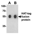 Hat Tag Antibody - Western blot analysis of a HAT-tag-containing recombinant protein with HAT-tag antibody at (A) 0.125 and (B) 0.25 ug/ml.