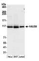 HAUS6 / FAM29A Antibody - Detection of human HAUS6 by western blot. Samples: Whole cell lysate (50 µg) from HeLa, HEK293T, and Jurkat cells prepared using NETN lysis buffer. Antibody: Affinity purified rabbit anti-HAUS6 antibody used for WB at 0.1 µg/ml. Detection: Chemiluminescence with an exposure time of 75 seconds.