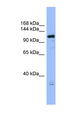 HAUS6 / FAM29A Antibody - HAUS6 / FAM29A antibody Western blot of MCF7 cell lysate. This image was taken for the unconjugated form of this product. Other forms have not been tested.