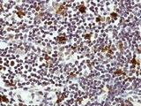 HAUS8 Antibody - IHC of paraffin-embedded Human lymph tissue using HAUS8 antibody at 1:50 dilution.