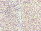 HAUS8 Antibody - Immunohistochemistry of paraffin-embedded human tonsil tissue at dilution of 1:100