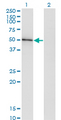 HAVCR1 / KIM-1 Antibody - Western blot of HAVCR1 expression in transfected 293T cell line by HAVCR1 monoclonal antibody (M03), clone 2G11.